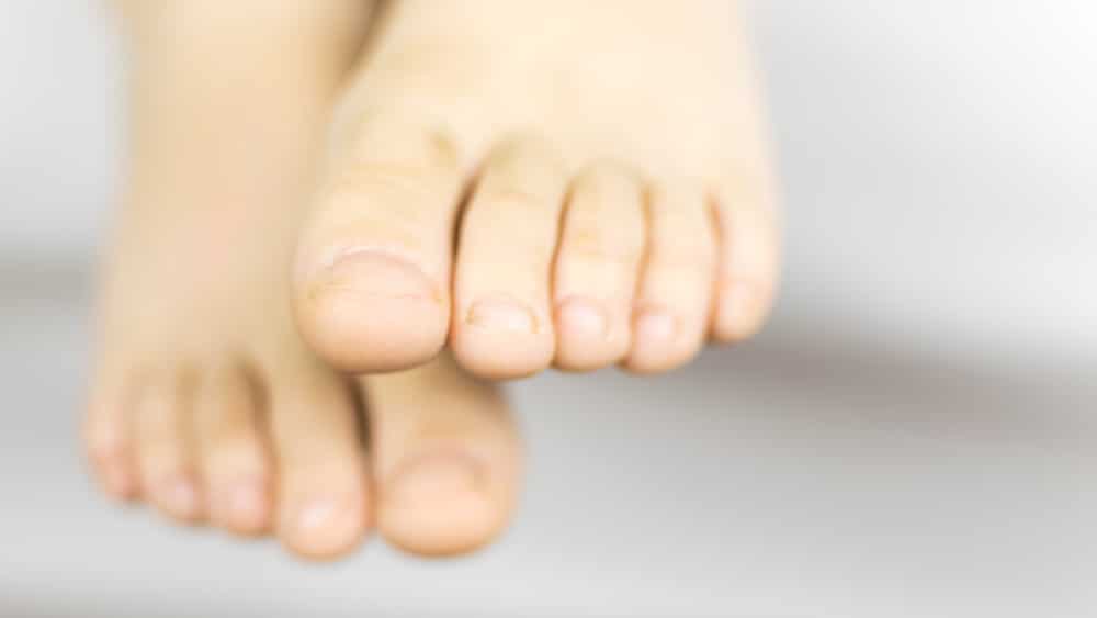 solutions blanchir ongles des pieds